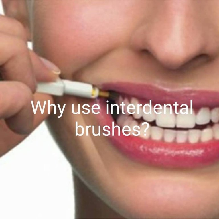 Why Use Interdental Brushes Britten Perio
