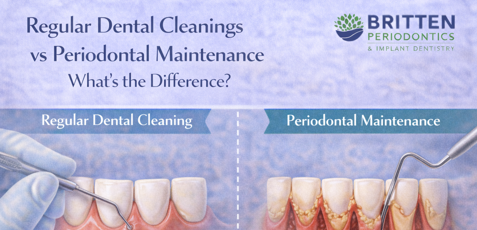 Graphic comparing regular dental cleanings and periodontal maintenance, showing surface cleaning above the gumline versus deeper cleaning below the gums for patients with gum disease, featuring the Britten Periodontics and Implant Dentistry logo.