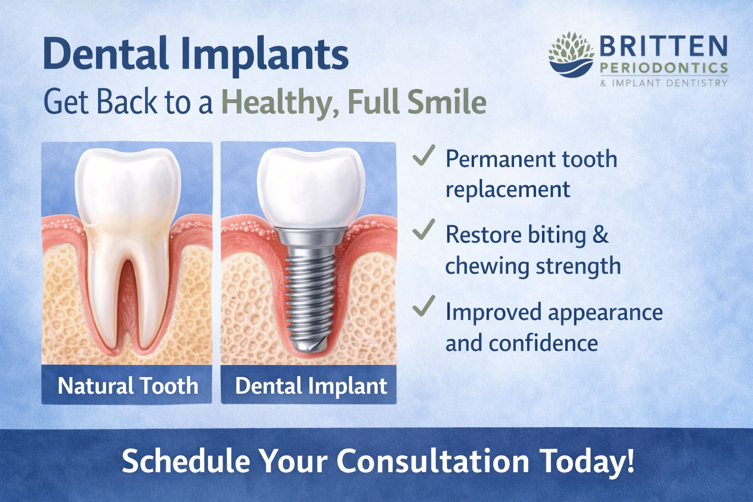 Dental implant compared to a natural tooth, showing how implants replace missing teeth and restore chewing function, featuring the Britten Periodontics and Implant Dentistry logo.
