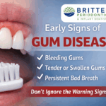 Early signs of gum disease shown with healthy-looking gums and toothbrush, featuring the Britten Perio logo and educational text about bleeding, tender gums, and bad breath.