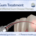 Dental laser used to treat infected gum tissue around teeth as part of laser gum disease treatment, featuring the Britten Periodontics and Implant Dentistry logo.