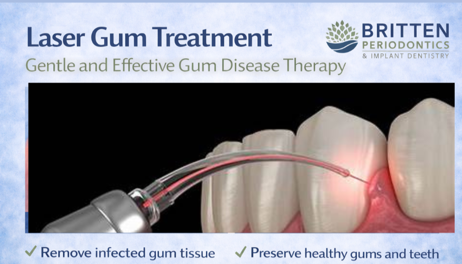 Dental laser used to treat infected gum tissue around teeth as part of laser gum disease treatment, featuring the Britten Periodontics and Implant Dentistry logo.