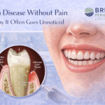Illustration showing gum disease without pain, with healthy-looking teeth above the gumline and hidden inflammation and tartar buildup revealed below, featuring the Britten Periodontics and Implant Dentistry logo.