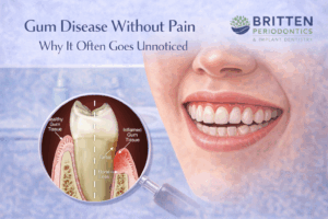 Illustration showing gum disease without pain, with healthy-looking teeth above the gumline and hidden inflammation and tartar buildup revealed below, featuring the Britten Periodontics and Implant Dentistry logo.