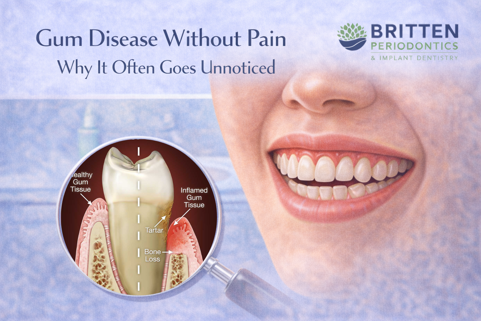 Illustration showing gum disease without pain, with healthy-looking teeth above the gumline and hidden inflammation and tartar buildup revealed below, featuring the Britten Periodontics and Implant Dentistry logo.