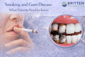 Illustration showing the effects of smoking on gum health, with cigarette smoke alongside inflamed gums and tartar buildup that contribute to gum disease, featuring the Britten Periodontics and Implant Dentistry logo.
