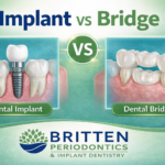 comparison of dental implant and dental bridge illustration