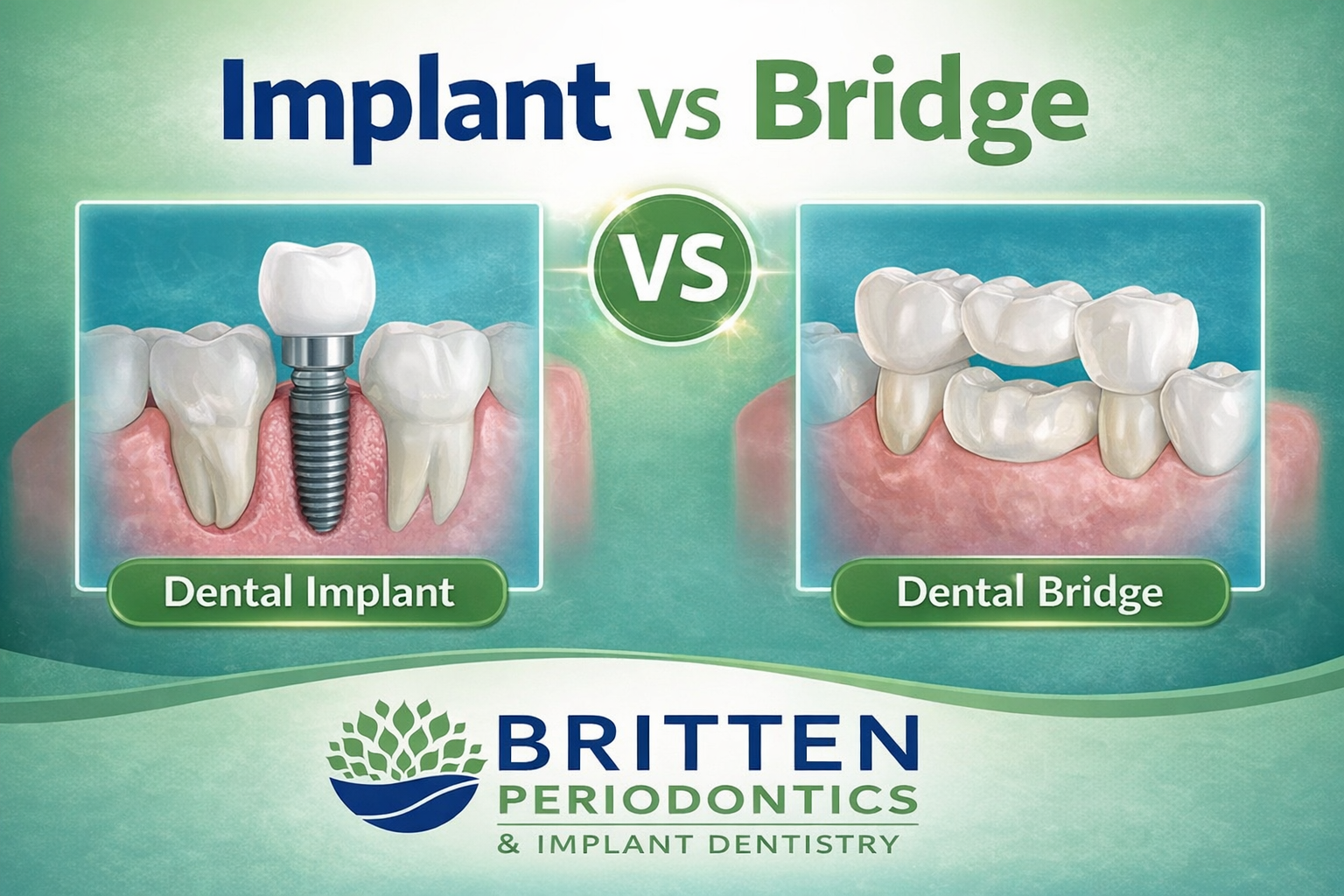 comparison of dental implant and dental bridge illustration